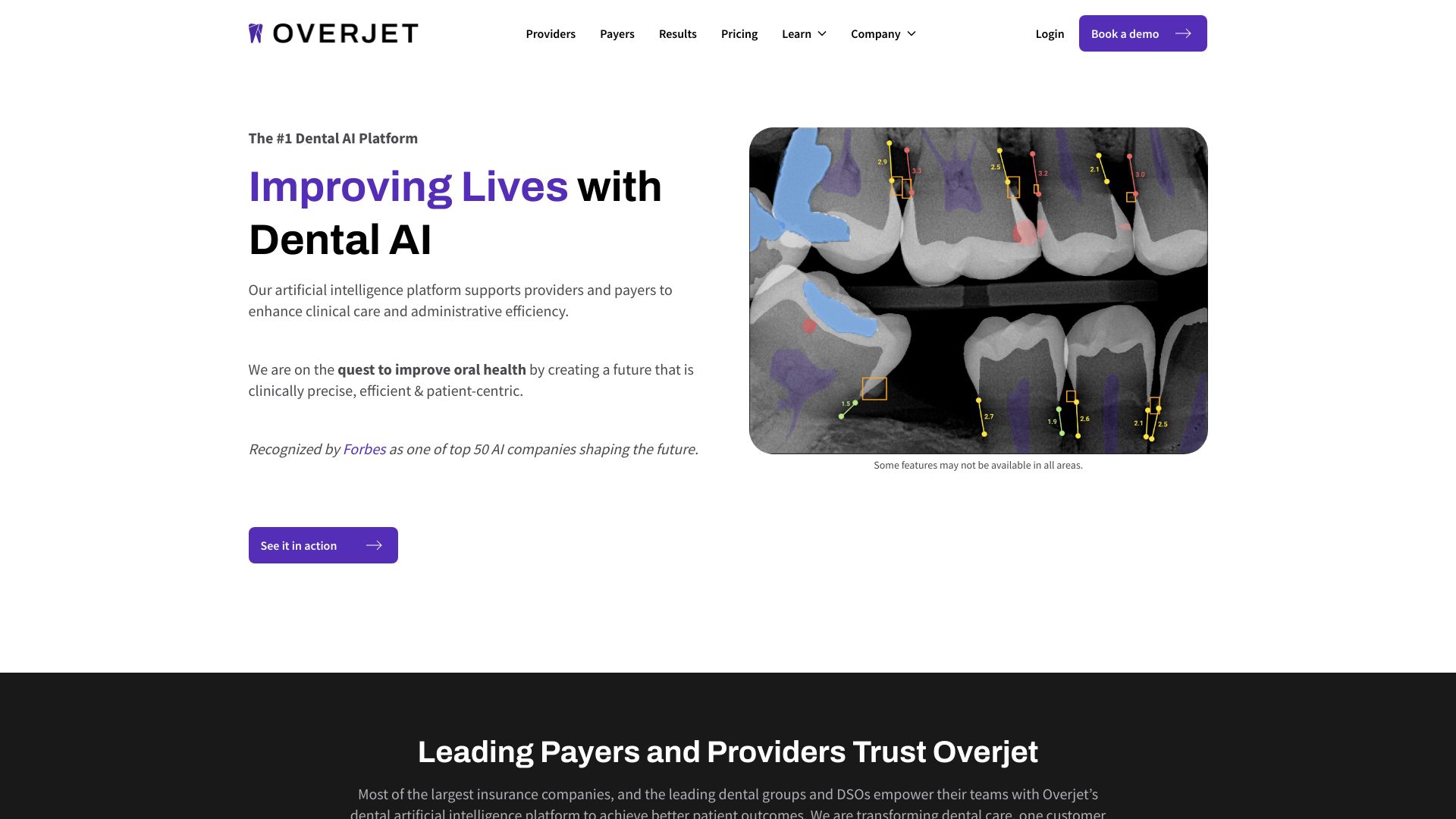 Overjet logo
