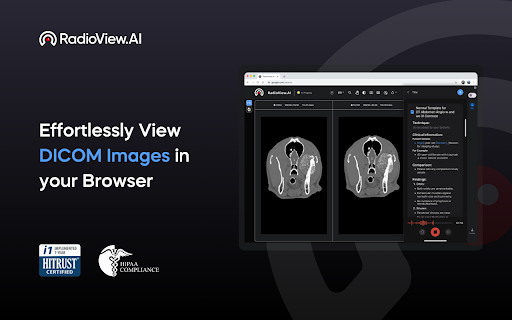 RadioView.AI ai chrome extension logo